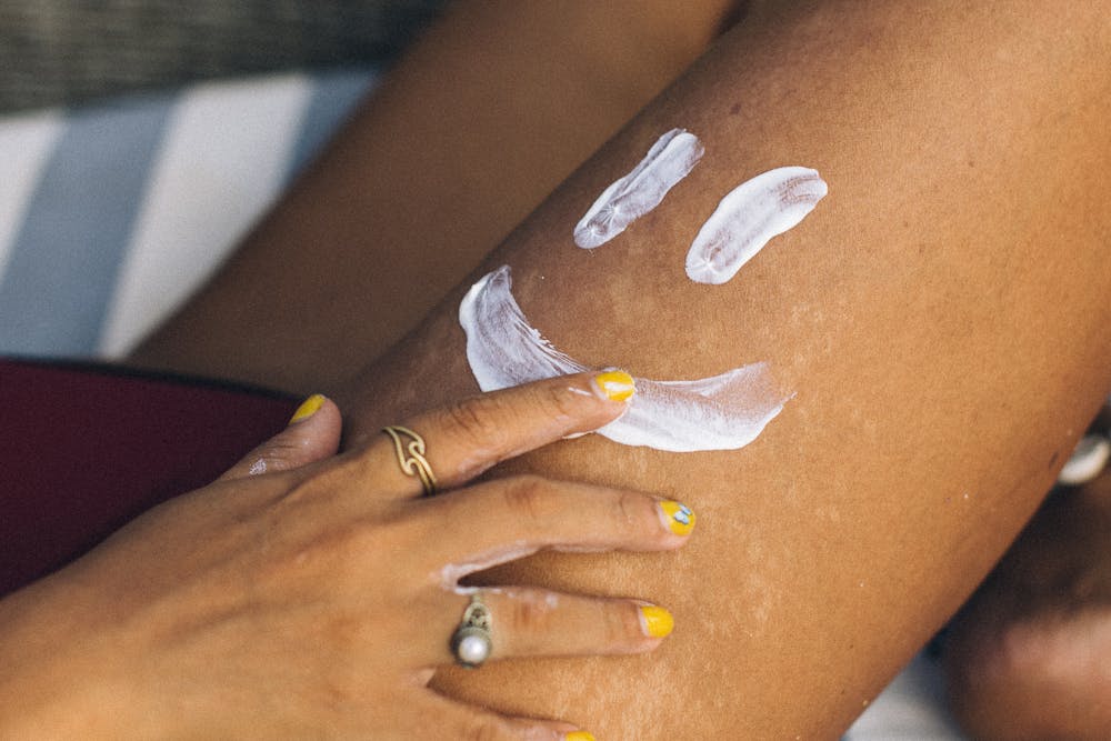 Sunshine Tips: Could CBD Help to Soothe Sunburn?